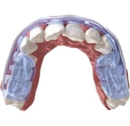AQUALIZER gouttière dentition ultra 1mm low